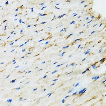 RAF1 Polyclonal Antibody - image 2