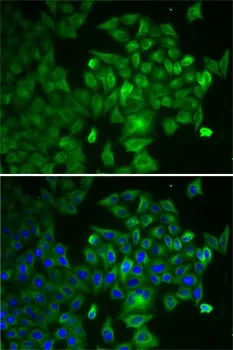 RAF1 Polyclonal Antibody - image 3