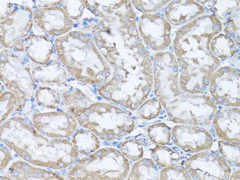Snail Polyclonal Antibody - image 1