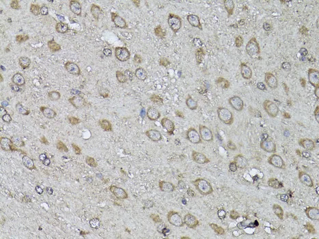 Snail Polyclonal Antibody - image 3
