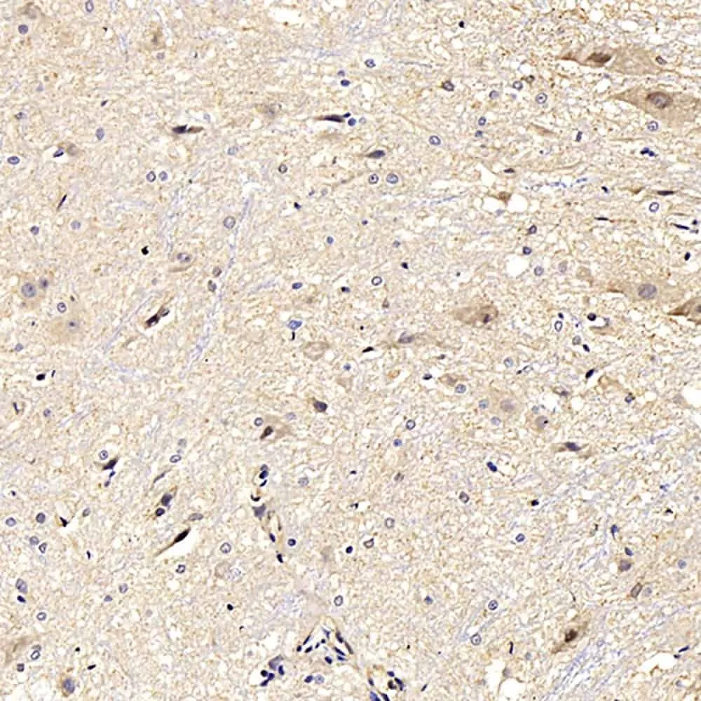 NOS2 Polyclonal Antibody - image 1