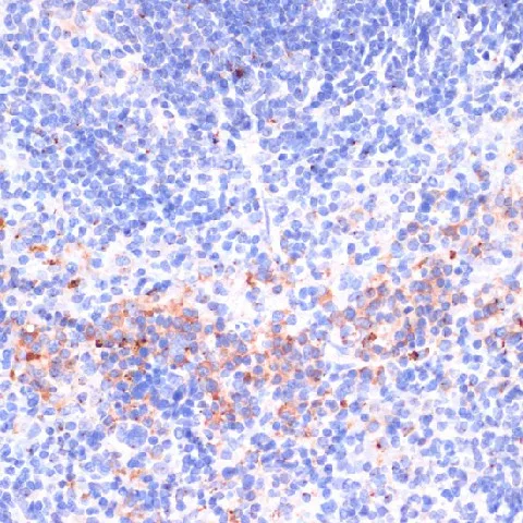 Perforin Polyclonal Antibody - image 1
