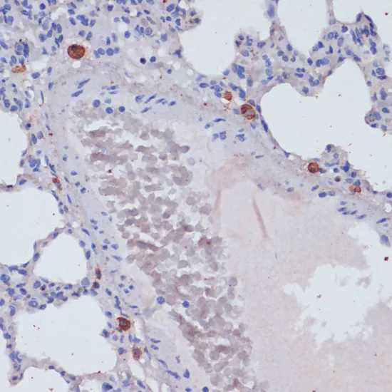 Perforin Polyclonal Antibody - image 2