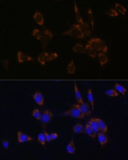 Perforin Polyclonal Antibody - image 3