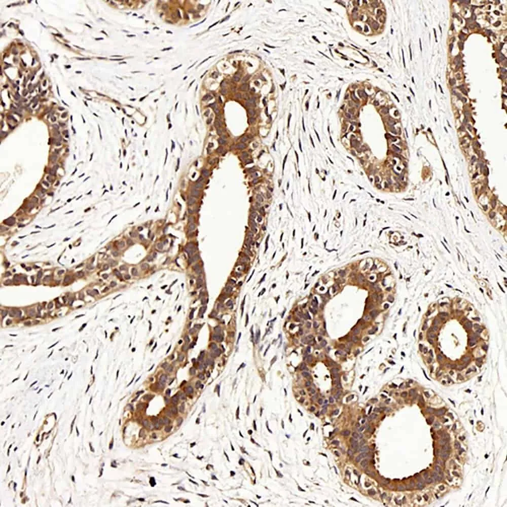 CDK4 Polyclonal Antibody - image 1