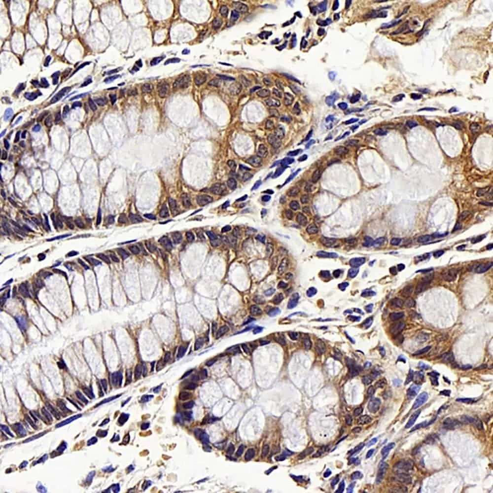 CDK4 Polyclonal Antibody - image 2