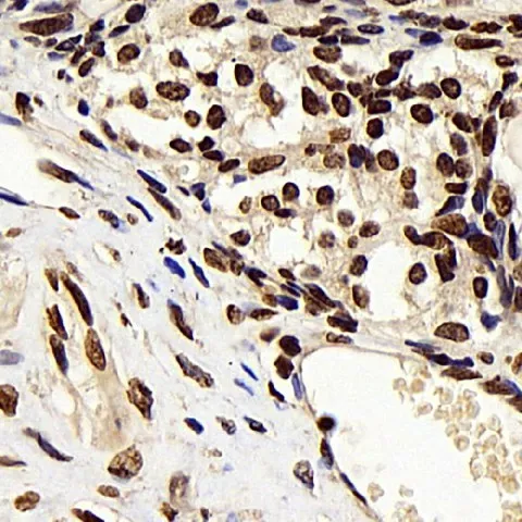 CDK4 Polyclonal Antibody - image 3