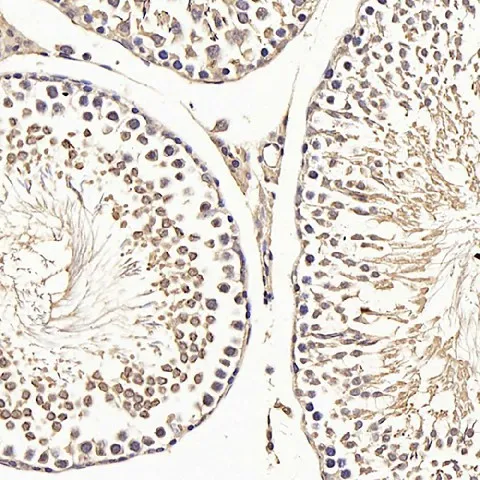 CDK4 Polyclonal Antibody - image 4