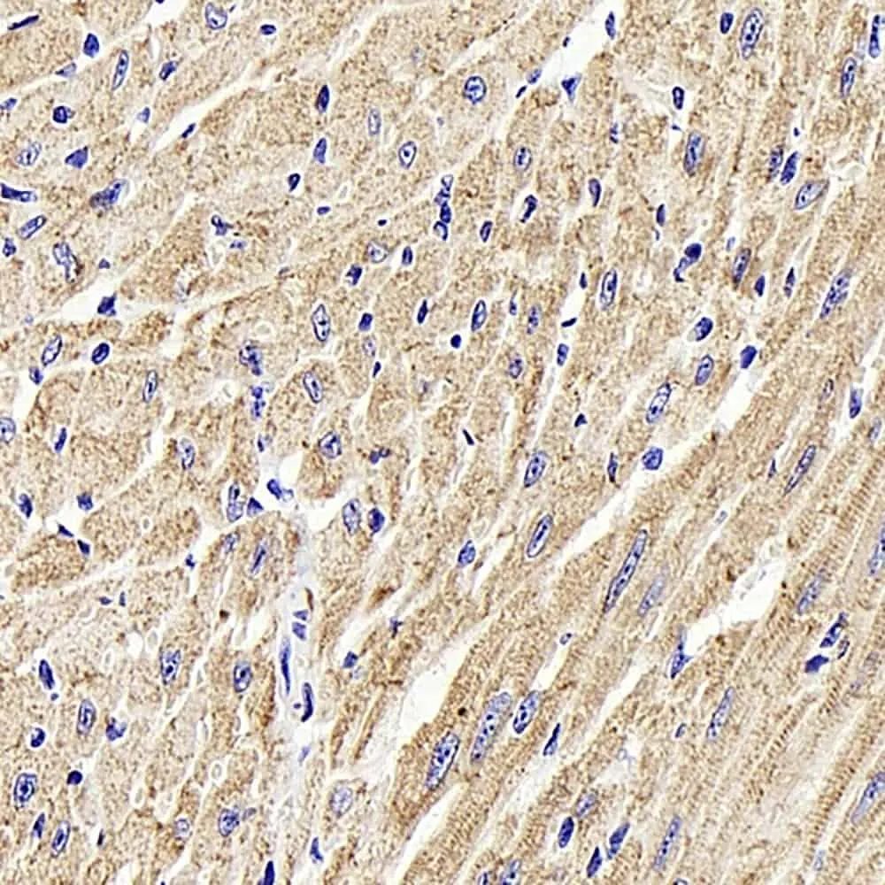 Desmin Polyclonal Antibody - image 1