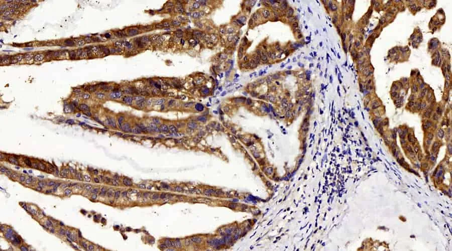 CHOP Polyclonal Antibody - image 1