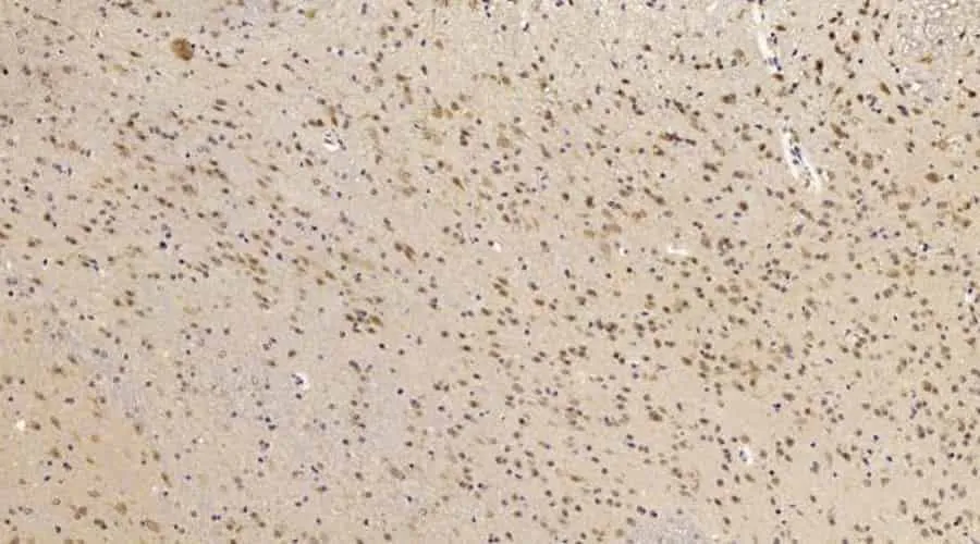 CHOP Polyclonal Antibody - image 2