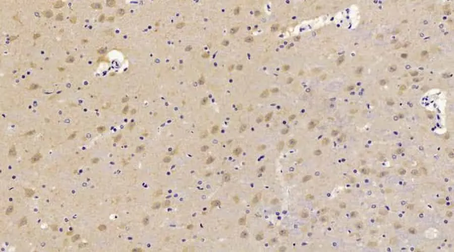 CHOP Polyclonal Antibody - image 3