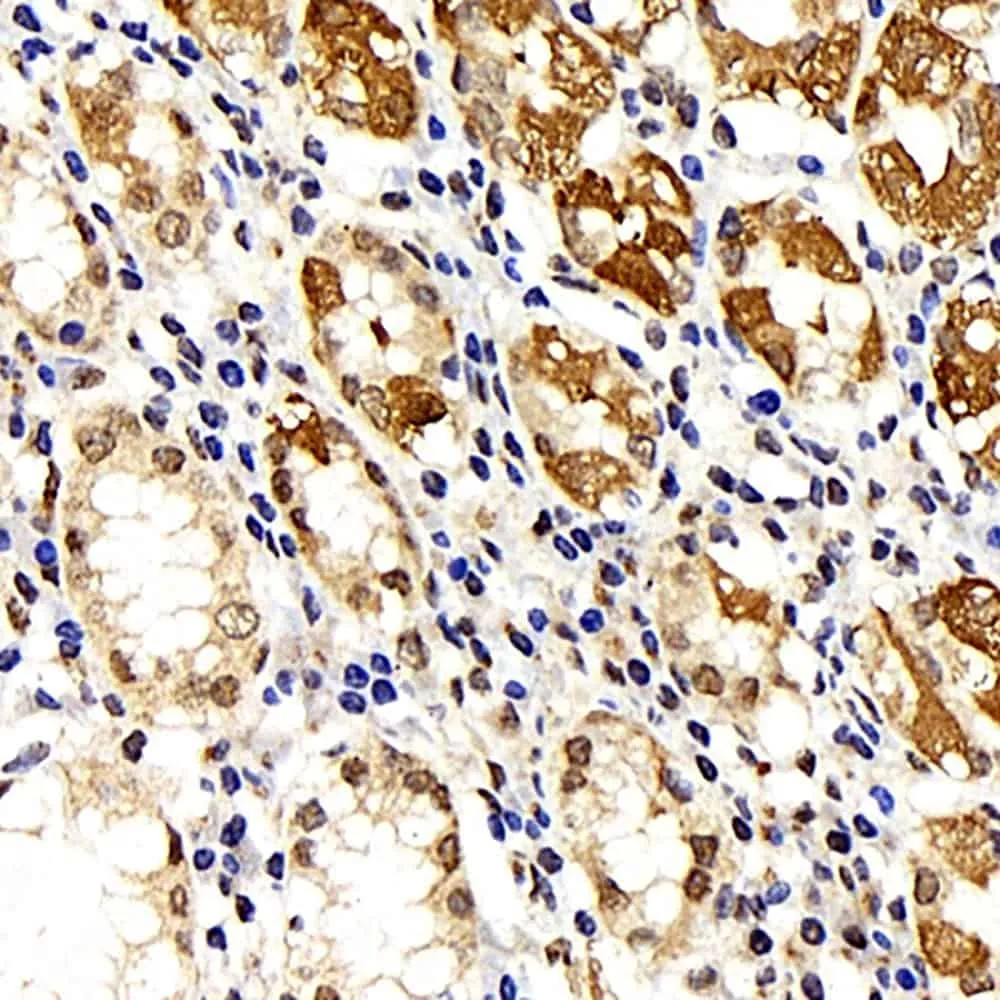 IkB alpha Polyclonal Antibody - image 1