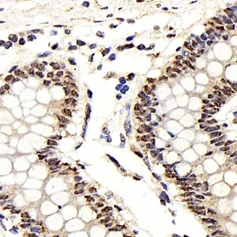 IkB alpha Polyclonal Antibody - image 2