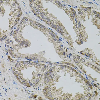 VIP Polyclonal Antibody - image 2
