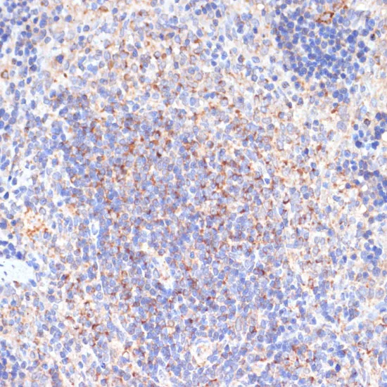 PDGFR beta Polyclonal Antibody - image 1