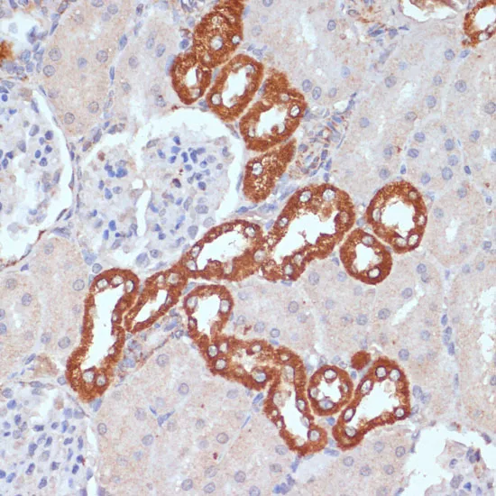 PDGFR beta Polyclonal Antibody - image 2