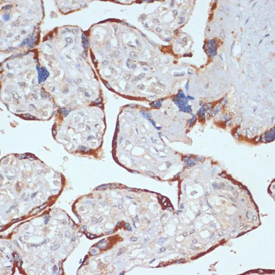 PDGFR beta Polyclonal Antibody - image 3