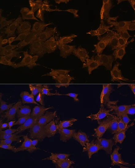 PDGFR beta Polyclonal Antibody - image 4