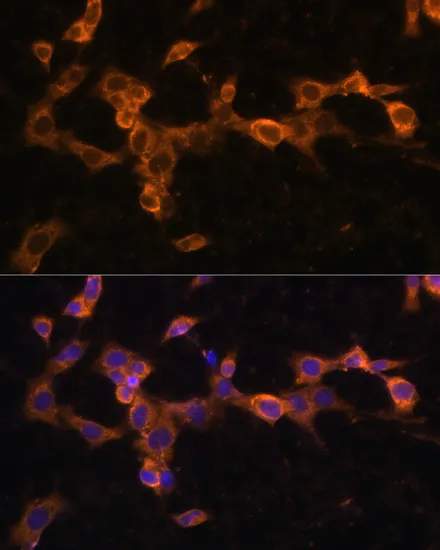 PDGFR beta Polyclonal Antibody - image 5