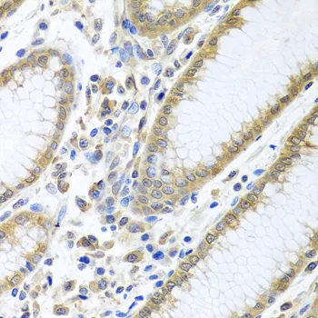 (KO Validated) EIF4E Polyclonal Antibody - image 1