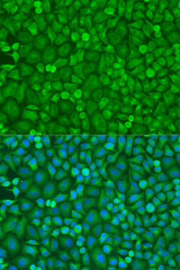 (KO Validated) EIF4E Polyclonal Antibody - image 2