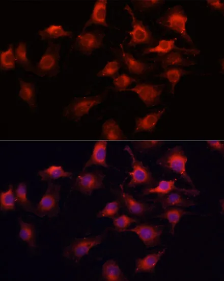 VEGFA Polyclonal Antibody - image 1