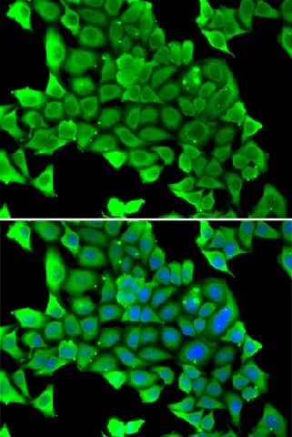 MYH1 Polyclonal Antibody - image 1