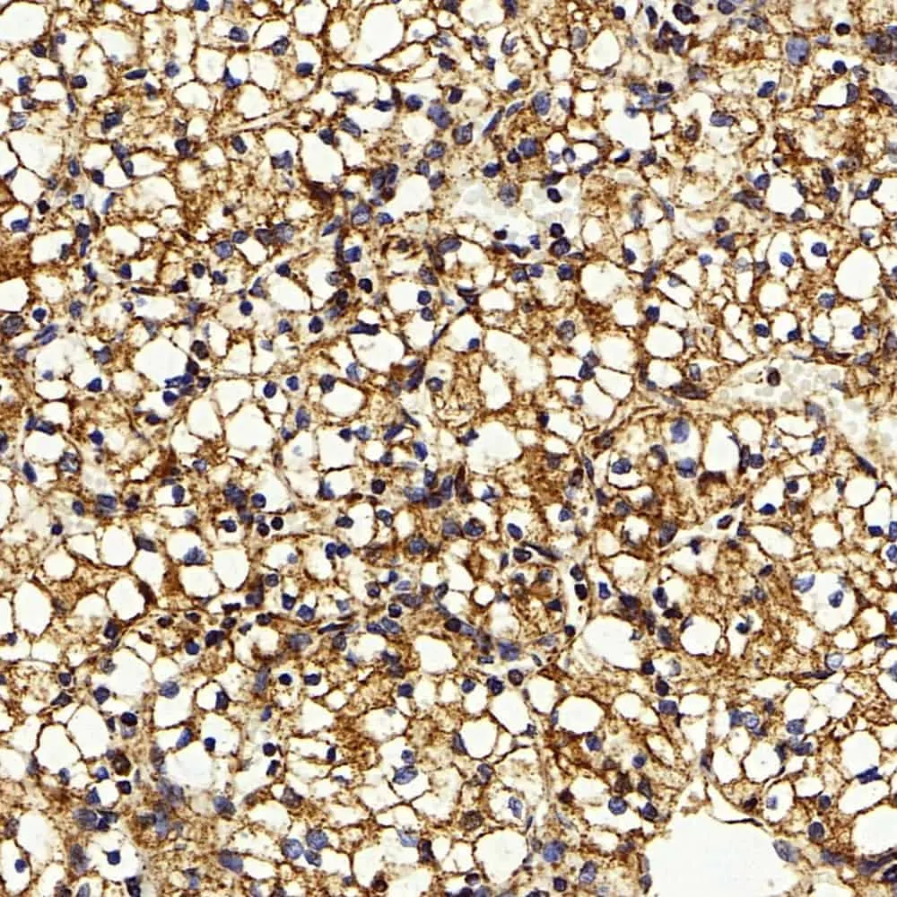 IGF1 Polyclonal Antibody - image 1