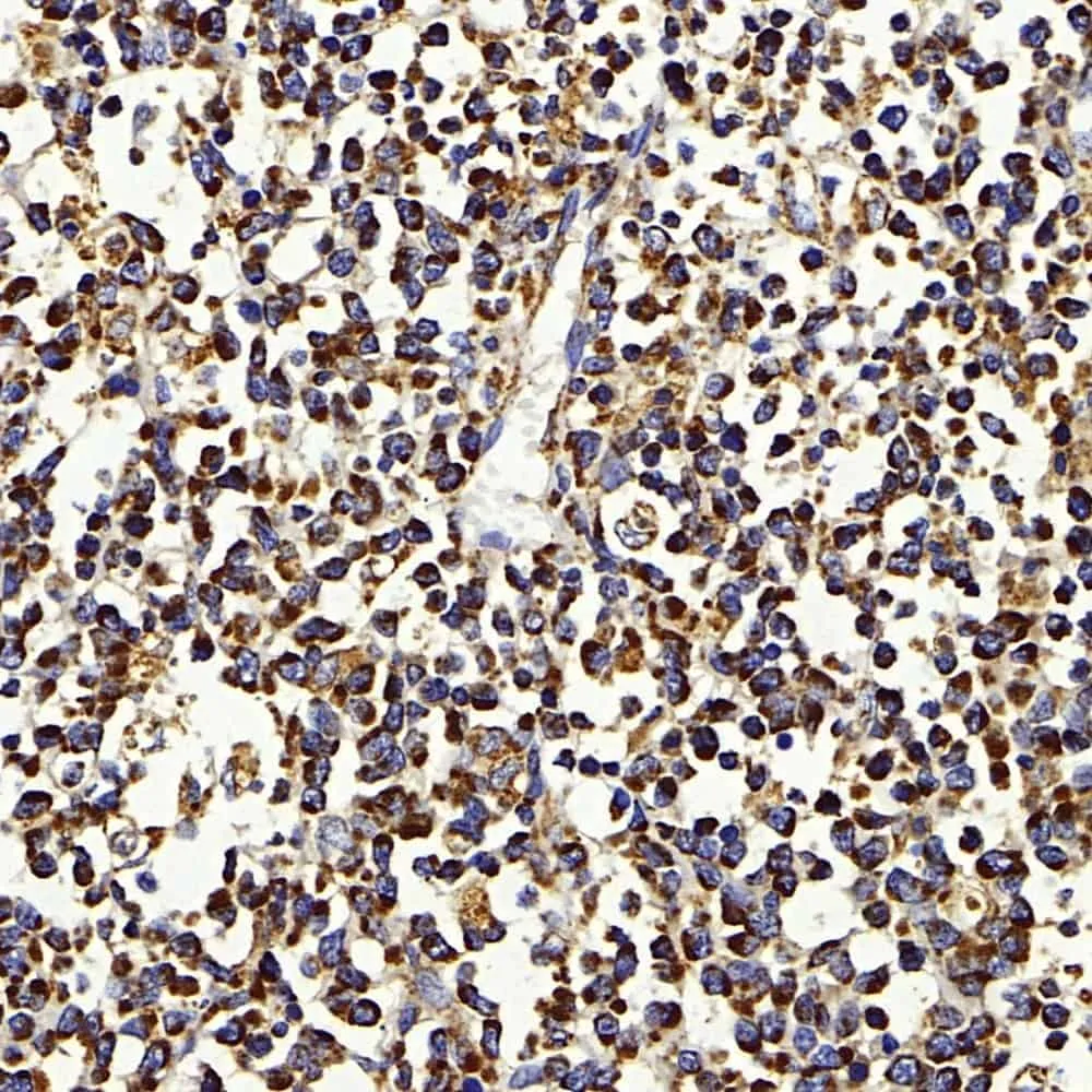 IGF1 Polyclonal Antibody - image 2