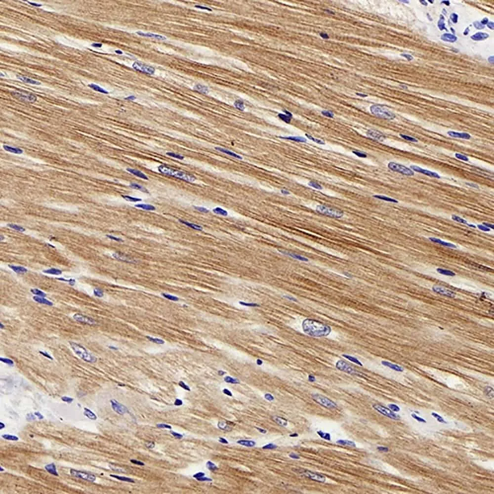 TNNT2 Polyclonal Antibody - image 1