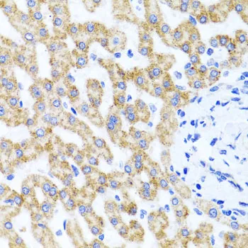 RIPK4 Polyclonal Antibody - image 1