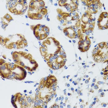 RIPK4 Polyclonal Antibody - image 2