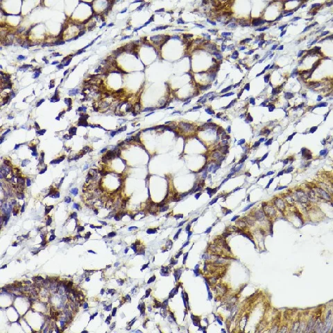 Cox2 Polyclonal Antibody - image 3
