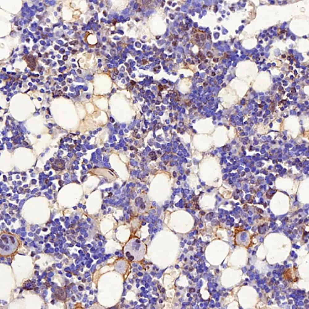 BMP2 Polyclonal Antibody - image 1