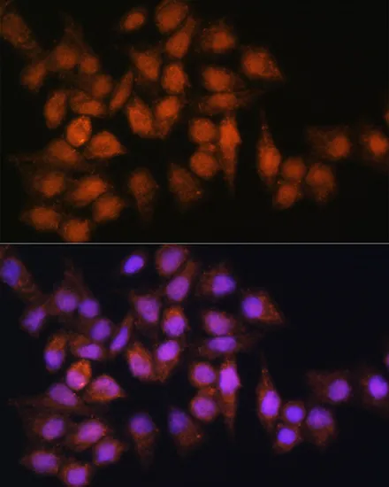 BPGM Polyclonal Antibody - image 1