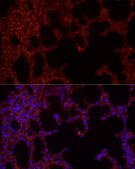 NLRC4 Polyclonal Antibody - image 2