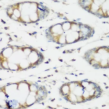 BMP2 Polyclonal Antibody - image 1