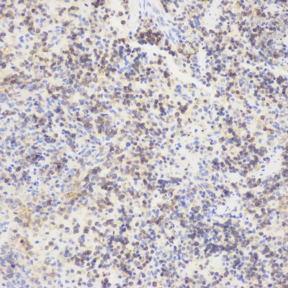 CD45 Polyclonal Antibody - image 1