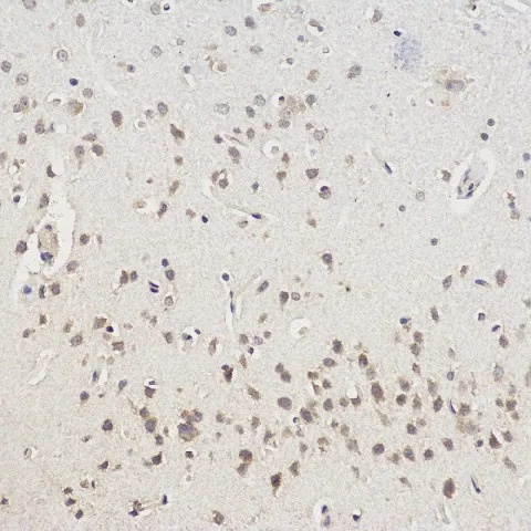 CHAT Polyclonal Antibody - image 1