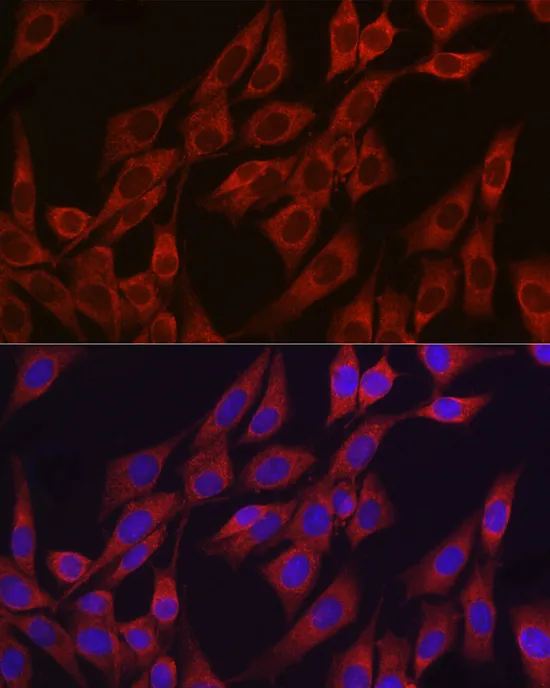 VEGF Polyclonal Antibody - image 2