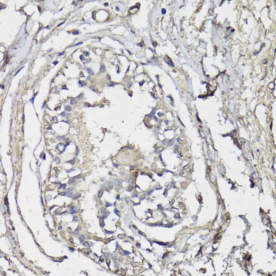 BAP1 Polyclonal Antibody - image 1