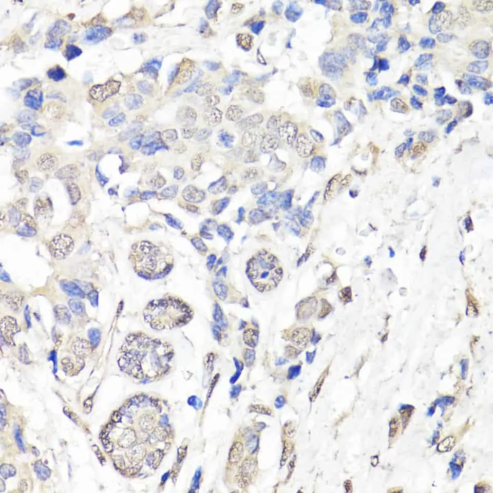 BAP1 Polyclonal Antibody - image 2