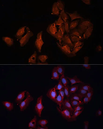 BAP1 Polyclonal Antibody - image 3