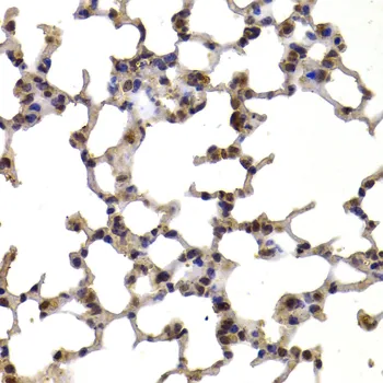 TXN Polyclonal Antibody - image 1