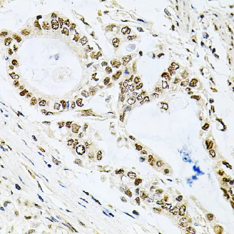 MCL1 Polyclonal Antibody - image 1
