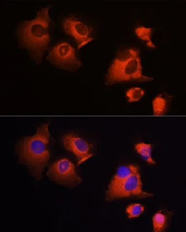 MCL1 Polyclonal Antibody - image 3