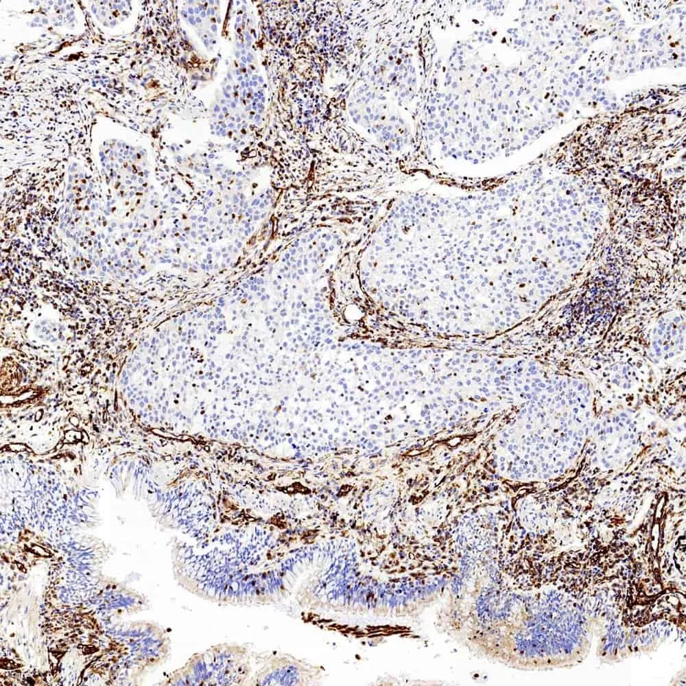 Vimentin Polyclonal Antibody - image 1