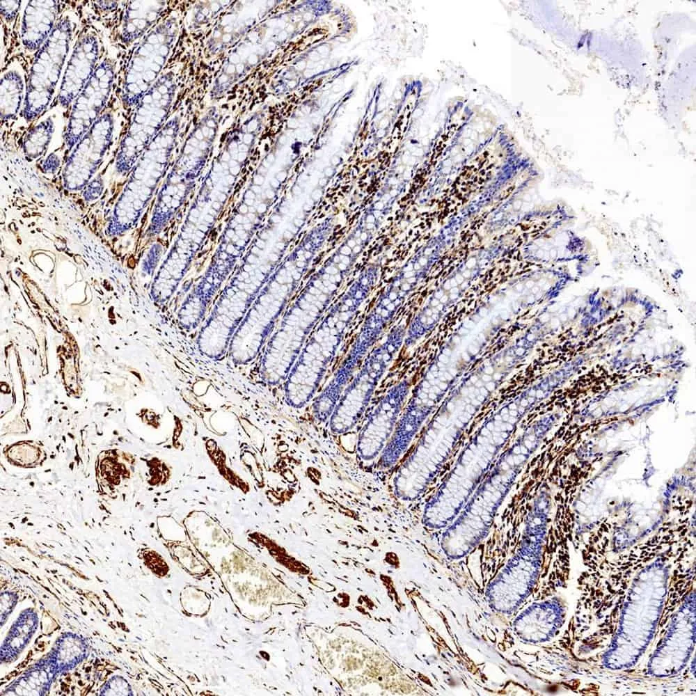 Vimentin Polyclonal Antibody - image 2