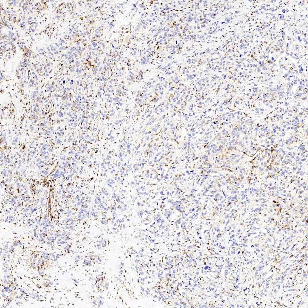 Vimentin Polyclonal Antibody - image 3